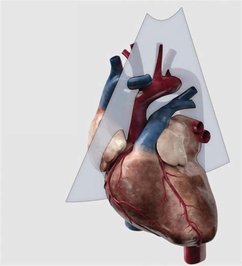 Discovering The Aorta Through Ultrasound Critical Care Sonography