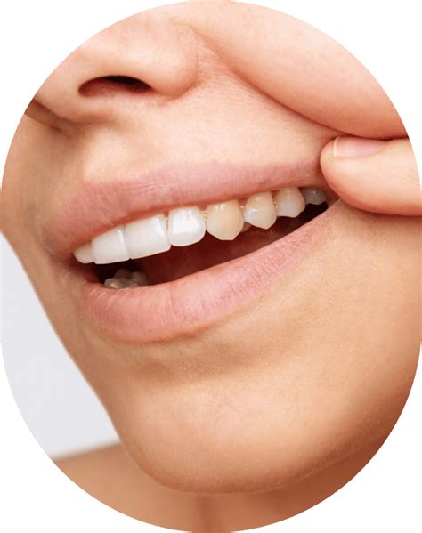 Teeth Cleaning Dental Center Of Redondo Beach