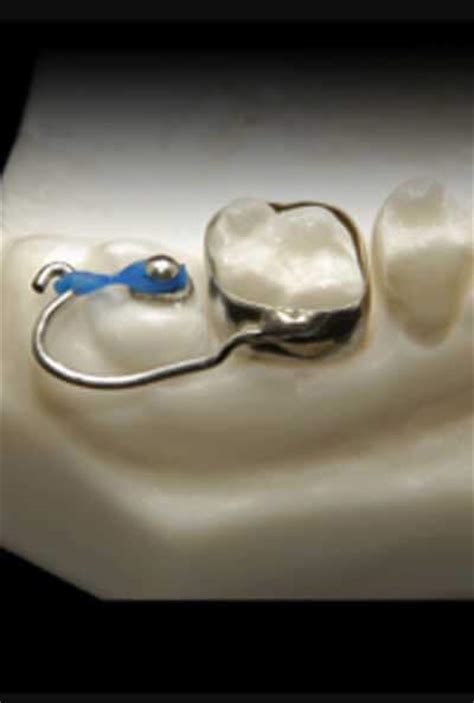 Orthodontic Services | Great Big Smiles