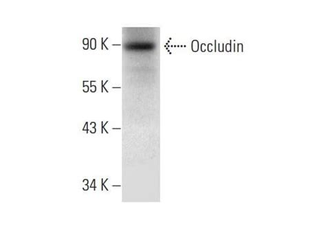 Occludin F Scbt Santa Cruz Biotechnology