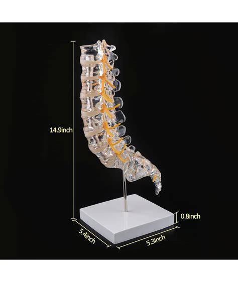 Ultrassist Modelo De Columna Lumbar Humana Con Sacro Nervios Espinales