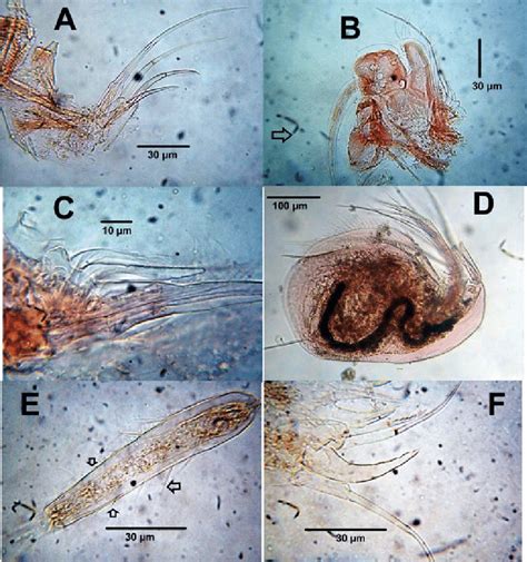 Cladocerans from a temporary pond, La Guajira. A-C. Grimaldina freyi ...