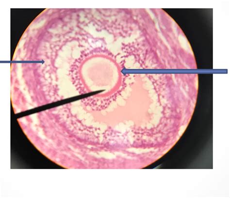 Secondary follicle- histology Diagram | Quizlet