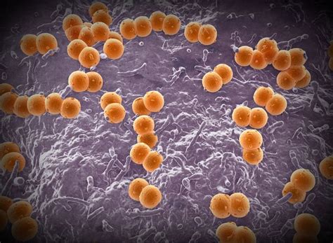 6 Dead amid Meningococcal Disease Outbreak Affecting Gay, Bisexual Men