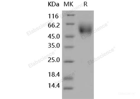 Quality Reliable Recombinant Human Dr Tnfrsf Protein His Tag