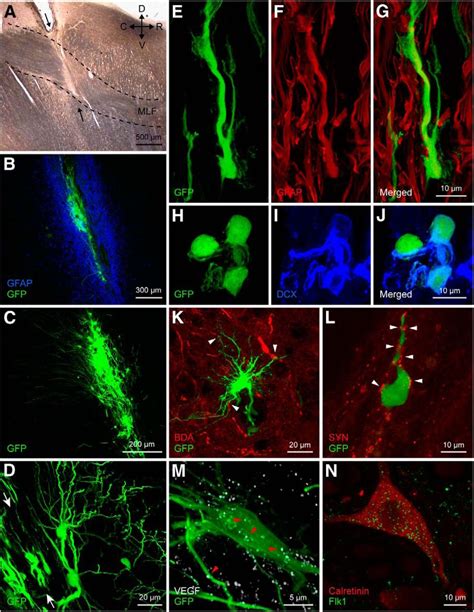 Neural Progenitor Cell Implants In The Lesioned Medial Longitudinal