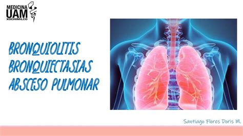 Bronquiolitis Bronquiectasias Y Absceso Pulmonar Bronquiolitis