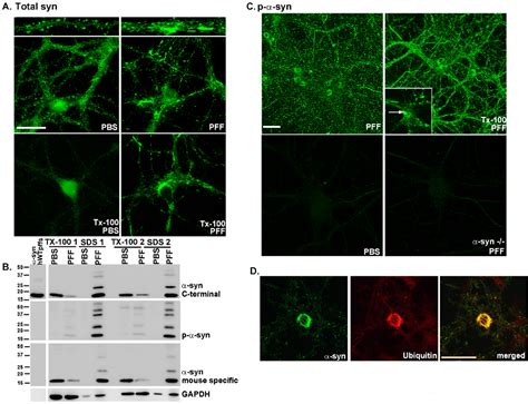 Figure 1 From Exogenous α Synuclein Fibrils Induce Lewy Body Pathology