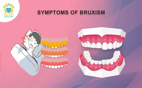 Temporomandibular Joint Elite Dental Care