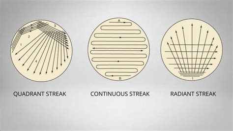 Streak Plate Method Patterns Procedure Principle Medical