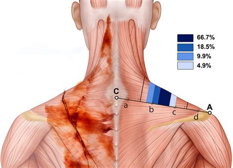 Left Photograph Of Sihlers Staining Of The Accessory Nerve Right