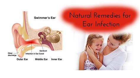 Best Natural Remedies For Ear Infection Fast Youtube