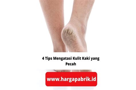 4 Tips Mengatasi Kulit Kaki Yang Pecah