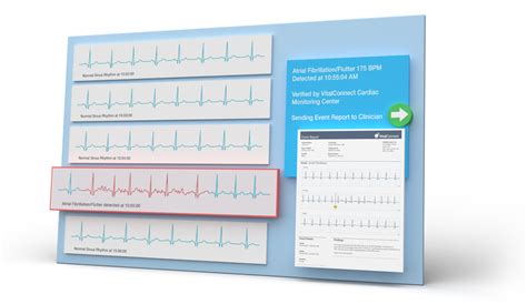 Cardiac Monitoring Vitalconnect