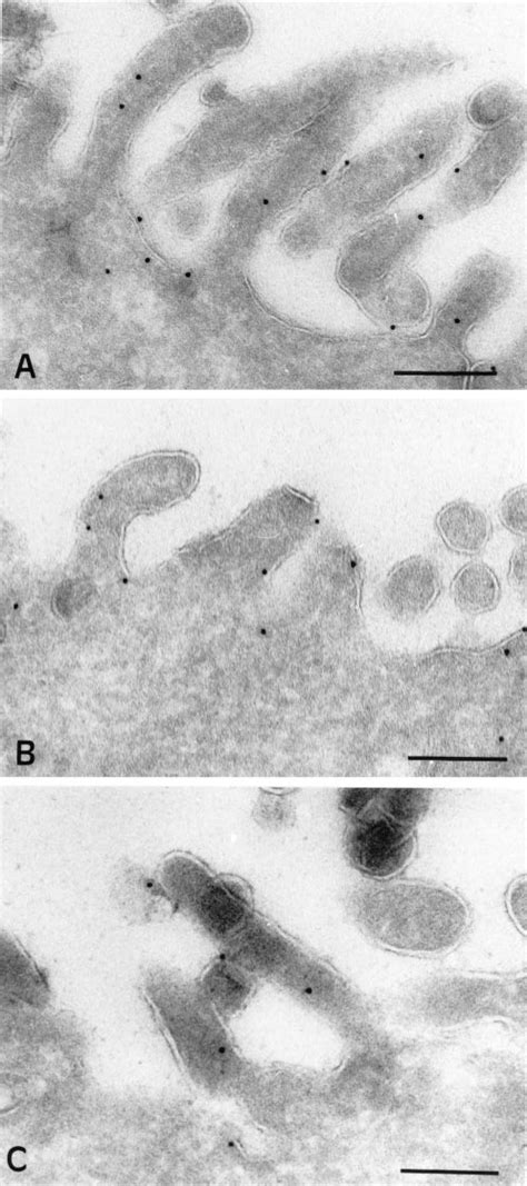 Immunogold Localization Of Syntaxin Snap And Ti Vamp In Caco