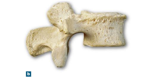 Ga Lumbar Vertebra Lateral View Diagram Quizlet