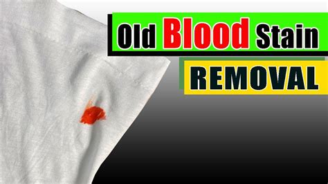 How To Remove Dried Blood Stains From Clothes Quick Easy Methods