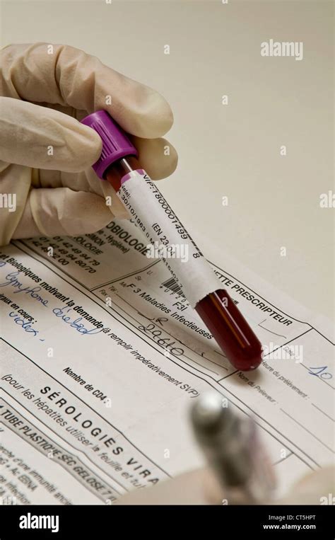 BLOOD ANALYSIS Stock Photo - Alamy