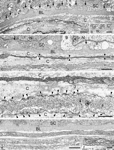 Electron Micrographs Of Ultrathin Cross Sections Through Peritubular