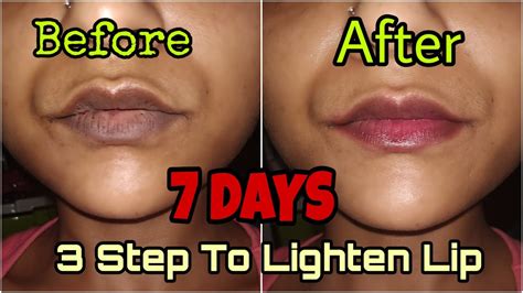 How Can I Lighten My Dark Lips Permanently Lipstutorial Org