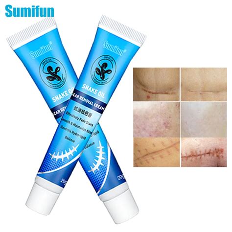 Sumifun 1pcs Skin Repair Ointment Scars Cream Remove Old Scar Fade Acne