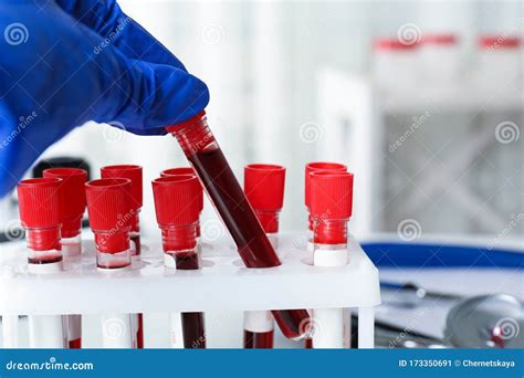 Wissenschaftler Der Reagenzglas Mit Bluttest Aus Dem Rack Im Labor