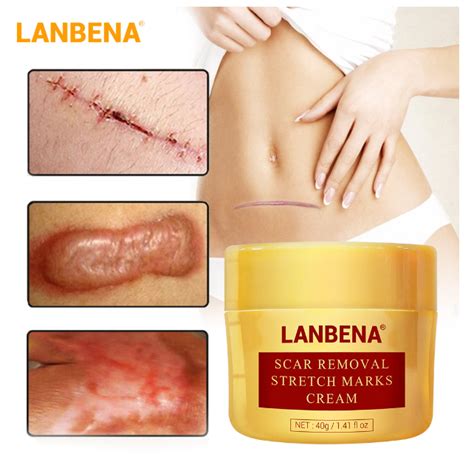 LANBENA Scar Removal Cream For New Old Scars Stretch Marks Relief