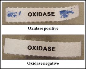 Oxidase Test: Principle, Procedure, Results – Microbe Online