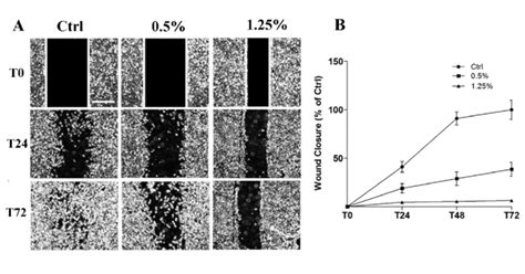 Cell Migration Evaluated By Wound Healing Assay In 1321n1 Cells Download Scientific Diagram