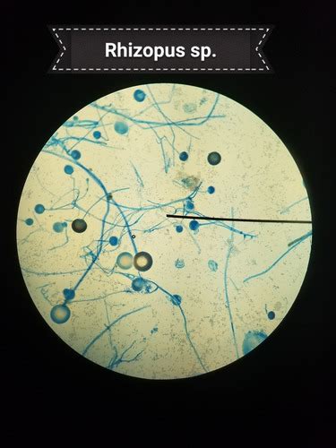 Rhizopus Oryzae Flashcards Quizlet