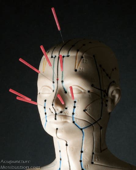 Acupuncture And Acupressure Points For Sinusitis And Sinus Headache