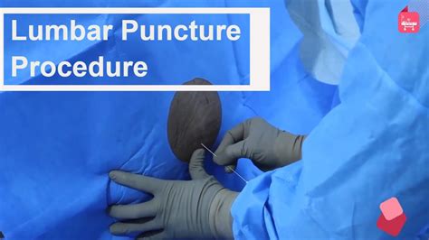 Lumbar Puncture Spinal Tapping Step By Step Procedure Youtube