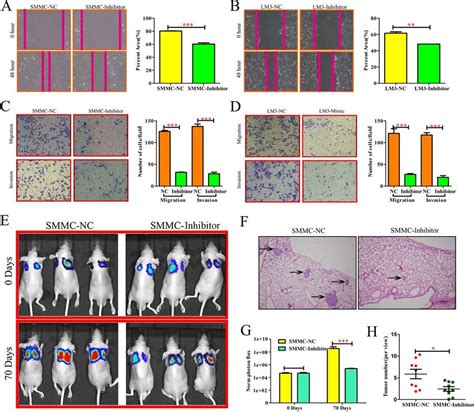miR-494-3p promoted metastasis and invasion of HCC cell in vitro and in ... 