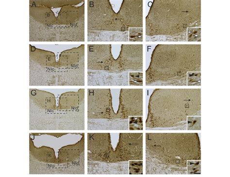 Representative Photomicrographs Of C Fos Expression In Relaxin 3 Ir Download Scientific Diagram