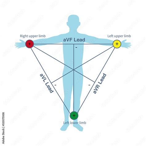 Fototapeta In The Einthoven Ecg Triangle The Lead Axis Of Augmented