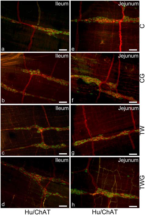 Representative Images Of Hu Chat Myenteric Neurons Double