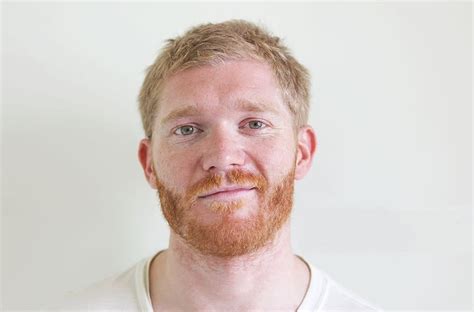 Unique Blonde Hair And Red Beard Styles We Love