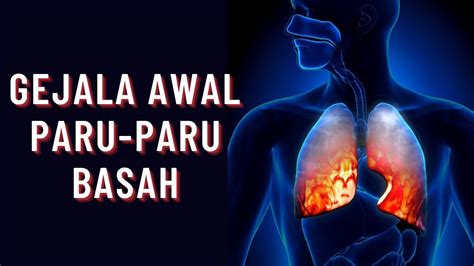 5 Gejala Paru Paru Basah Yang Harus Diwaspadai YouTube