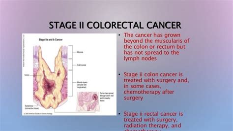 Colerectal Cancer Causes Symptoms And Treatments Global Treatment