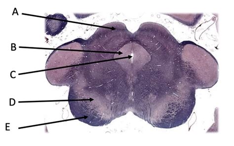 cross section through the midbrain Diagram | Quizlet