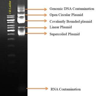 Agarose Gel Electrophoresis Image Of Plasmids Isolated By Different