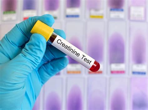 Normal Creatinine Levels in Urine | Livestrong.com