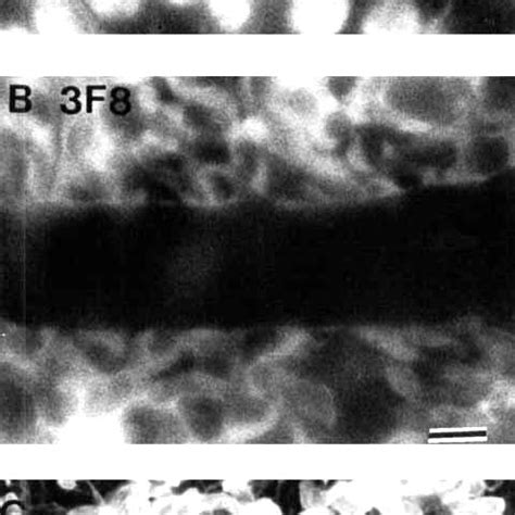 Astrocytes forming the glia limitans of vessels, shown by... | Download ...