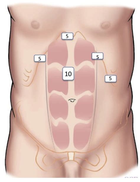 Figure 1 from Median arcuate ligament release. | Semantic Scholar