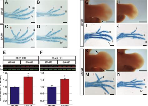 Increased Shh Protein From The Posterior Limb Is Required For The