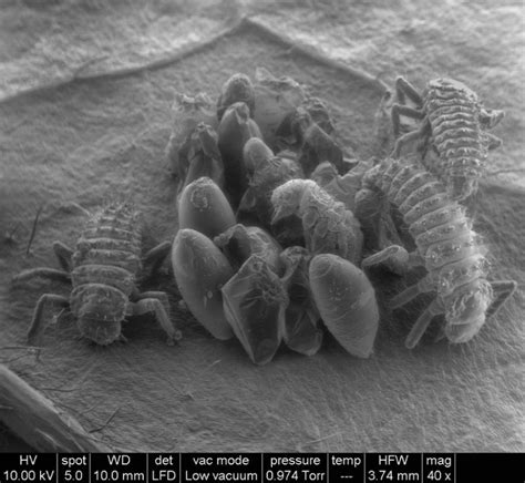 Las fotos tomadas con un microscopio electrónico Pictolic