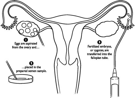 Female Reproductive System Drawing at GetDrawings | Free download