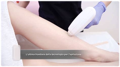 Epilazione Con Diodo Laser Youtube