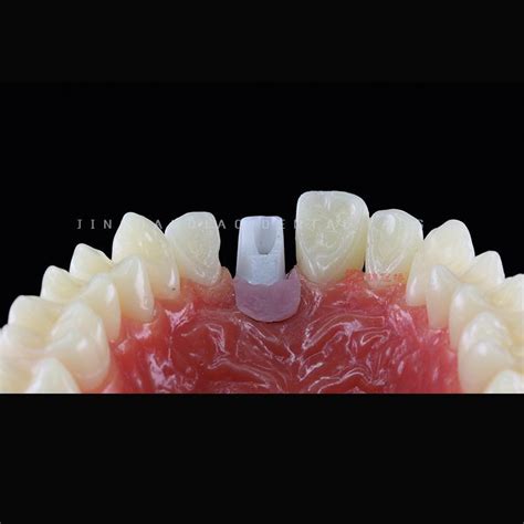 Full Arch Dental Implants Zirconia Milled Dentist Guides Dental Implant