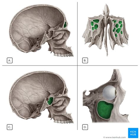 Schwannoma Of The Nasal Cavity Clinical Case Diagnosis Kenhub